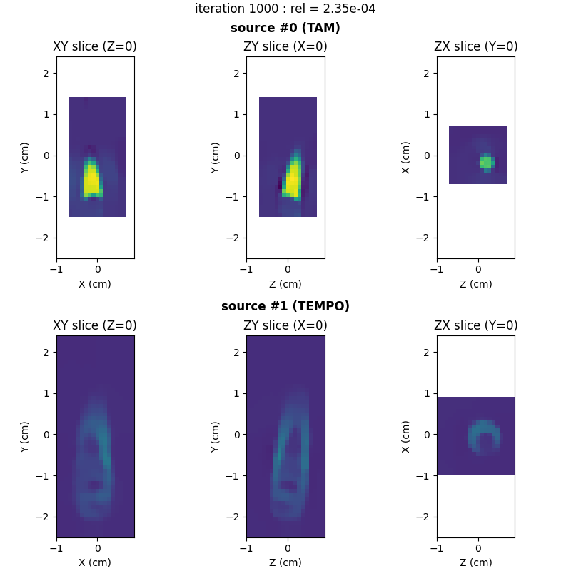 iteration 1000 : rel = 2.35e-04, XY slice (Z=0), ZY slice (X=0), ZX slice (Y=0), XY slice (Z=0), ZY slice (X=0), ZX slice (Y=0)