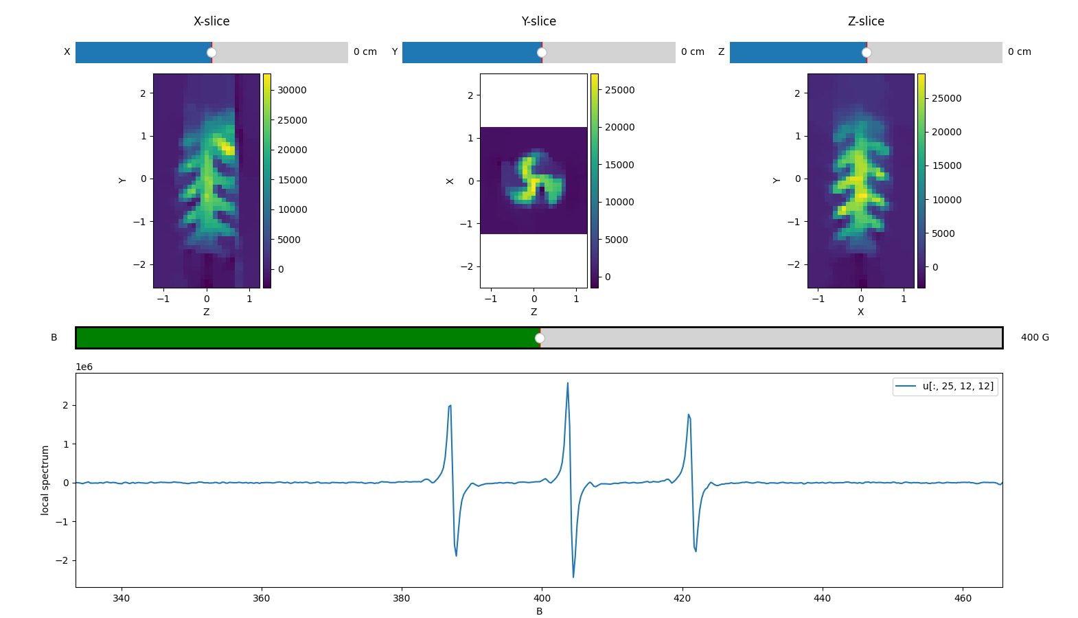 X-slice, Y-slice, Z-slice